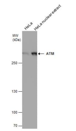 ATM Antibody (5C2), Novus Biologicals 0.1mL; Unlabeled:Antibodies, Monoclonal