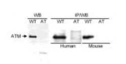ATM Antibody, Novus Biologicals 0.1mg; Unlabeled:Antibodies, Polyclonal