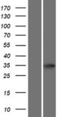Novus Biologicals&trade;&nbsp;ATOH8 Overexpression Lysate