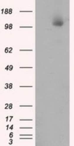 ATP Citrate Lyase Antibody (OTI3G8), Novus Biologicals 0.1mL; Unlabeled:Antibodies,