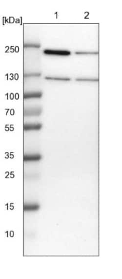 ATP Citrate Lyase Antibody, Novus Biologicals 0.1mL; Unlabeled:Antibodies,