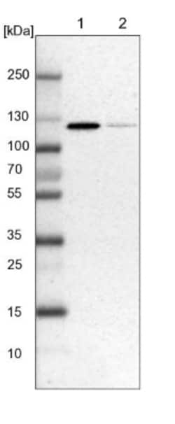 ATP Citrate Lyase Antibody, Novus Biologicals:Antibodies:Primary Antibodies