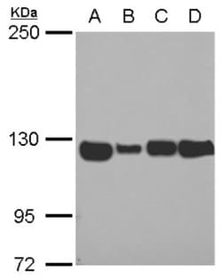 ATP Citrate Lyase Antibody, Novus Biologicals 0.1mL; Unlabeled:Antibodies,