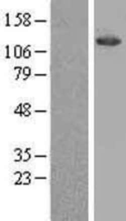 Novus Biologicals&trade;&nbsp;ATP Citrate Lyase Overexpression Lysate