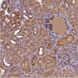 ATP10A Antibody, Novus Biologicals 0.1mL; Unlabeled:Antibodies, Polyclonal