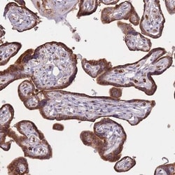 ATP10D Antibody, Novus Biologicals 25 &mu;L, Unlabeled:Anticuerpos