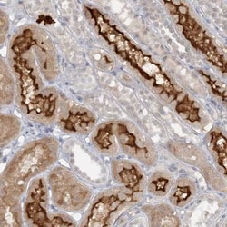 ATP11A Antibody, Novus Biologicals 0.1mL; Unlabeled:Antibodies, Polyclonal