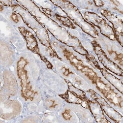 ATP11A Antibody, Novus Biologicals 0.1mL; Unlabeled:Antibodies, Polyclonal
