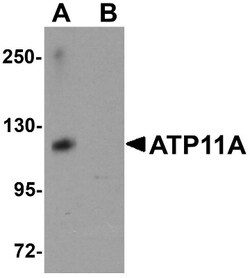 ATP11A Antibody - BSA Free, Novus Biologicals 0.025 mg, Unconjugated:Antibodies,