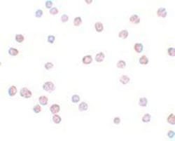 ATP11B Antibody - BSA Free, Novus Biologicals 0.1mg; Unlabeled:Antibodies,