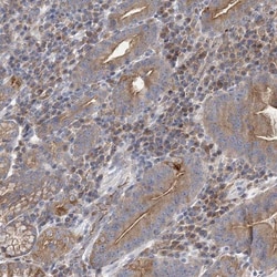 ATP11B Antibody, Novus Biologicals:Antibodies:Primary Antibodies