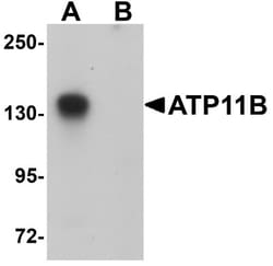 ATP11B Antibody - BSA Free, Novus Biologicals 0.1mg; Unlabeled:Antibodies,