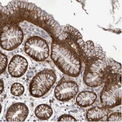ATP13A1 Antibody, Novus Biologicals:Antibodies:Primary Antibodies