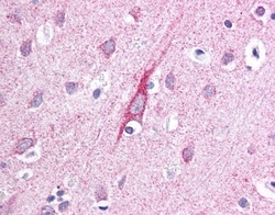 ATP13A2 Antibody, Novus Biologicals 0.1mL; Unlabeled:Antibodies, Polyclonal