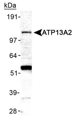ATP13A2 Antibody, Novus Biologicals 0.1mL; Unlabeled:Antibodies, Polyclonal