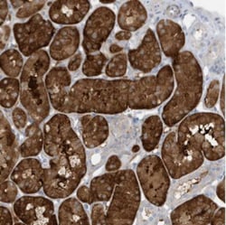 ATP13A5 Antibody, Novus Biologicals 0.1mL; Unlabeled:Antibodies, Polyclonal