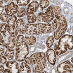 ATP13A5 Antibody, Novus Biologicals:Antibodies:Primary Antibodies
