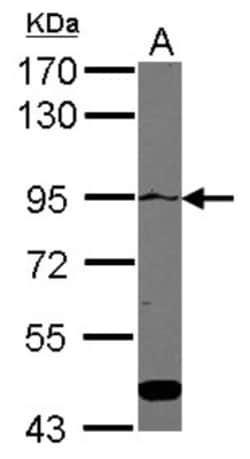 ATP2C1 Antibody, Novus Biologicals 0.1mL; Unlabeled:Antibodies, Polyclonal
