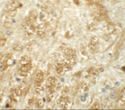 ATP2C1 Antibody - BSA Free, Novus Biologicals:Antibodies:Primary Antibodies