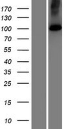 Novus Biologicals&trade;&nbsp;ATP2C2 Overexpression Lysate