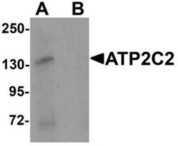 ATP2C2 Antibody - BSA Free, Novus Biologicals 0.025 mg, Unconjugated:Antibodies,