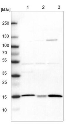 ATP5D Antibody, Novus Biologicals:Antibodies:Primary Antibodies
