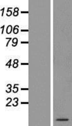 Novus Biologicals&trade;&nbsp;ATP5E Overexpression Lysate
