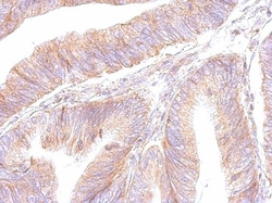 ATP5F1 Antibody, Novus Biologicals 0.1mL; Unlabeled:Antibodies, Polyclonal