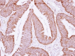 ATP5F1 Antibody, Novus Biologicals 0.1mL; Unlabeled:Antibodies, Polyclonal