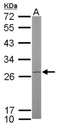 ATP5F1 Antibody, Novus Biologicals 0.1mL; Unlabeled:Antibodies, Polyclonal