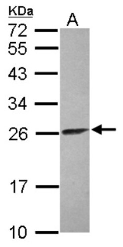 ATP5F1 Antibody, Novus Biologicals 0.1mL; Unlabeled:Antibodies, Polyclonal