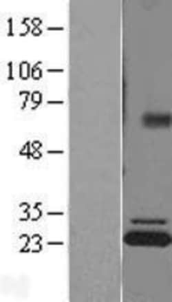 Novus Biologicals™ ATP5F1 Overexpression Lysate