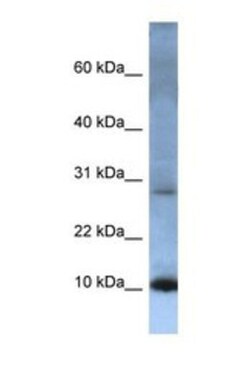 ATP5G2 Antibody, Novus Biologicals 0.05mg; Unlabeled:Antibodies, Polyclonal