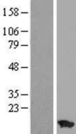 Novus Biologicals&trade;&nbsp;ATP5I Overexpression Lysate