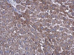 ATP5L Antibody, Novus Biologicals 0.1mL; Unlabeled:Antibodies, Polyclonal