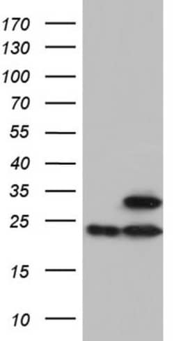 ATP5O Antibody (OTI2E9), Novus Biologicals 0.1 mL | Buy Online | Novus Biologicals | Fisher Scientific