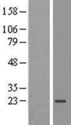 Novus Biologicals™ ATP5O Overexpression Lysate