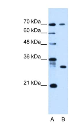 ATP6AP1L Antibody, Novus Biologicals:Antibodies:Primary Antibodies
