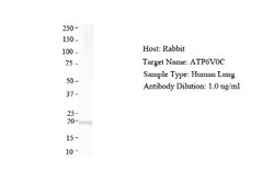 ATP6V0C Antibody, Novus Biologicals 0.05mg; Unlabeled:Antibodies, Polyclonal
