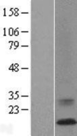 Novus Biologicals™ ATP6V0C Overexpression Lysate