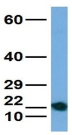 ATP6V0C Antibody, Novus Biologicals 0.05mg; Unlabeled:Antibodies, Polyclonal