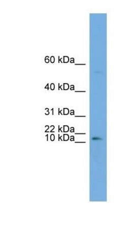 ATP6V0C Antibody, Novus Biologicals 0.05mg; Unlabeled:Antibodies, Polyclonal