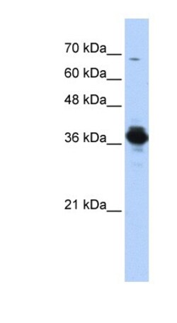 ATP6V0D2 Antibody, Novus Biologicals 0.05mg; Unlabeled:Antibodies, Polyclonal