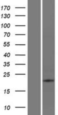 Novus Biologicals&trade;&nbsp;ATP6V0E2 Overexpression Lysate