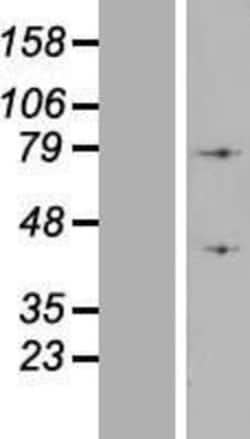 Novus Biologicals&trade;&nbsp;ATP6V1A Overexpression Lysate
