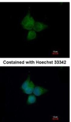 ATP6V1A Antibody, Novus Biologicals 0.1mL; Unlabeled:Antibodies, Polyclonal