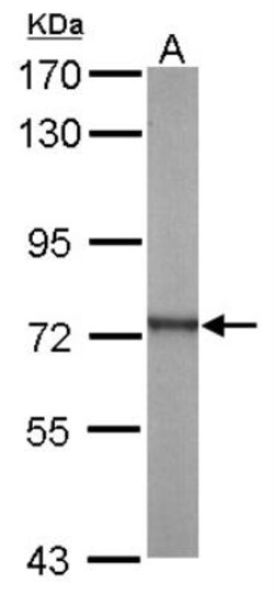 ATP6V1A Antibody, Novus Biologicals 0.1mL; Unlabeled:Antibodies, Polyclonal