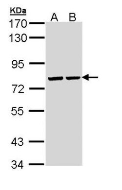 ATP6V1A Antibody, Novus Biologicals 0.1mL; Unlabeled:Antibodies, Polyclonal