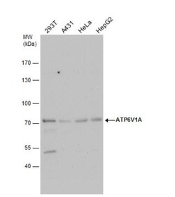 ATP6V1A Antibody, Novus Biologicals 0.1mL; Unlabeled:Antibodies, Polyclonal