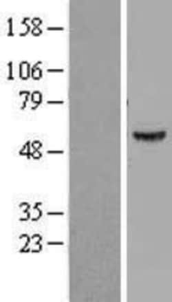 Novus Biologicals&trade;&nbsp;ATP6V1B1 Overexpression Lysate